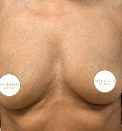 mia-femtech-009-pred