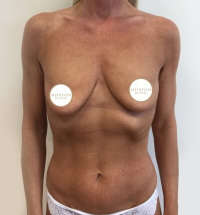 mia-femtech-014-pred