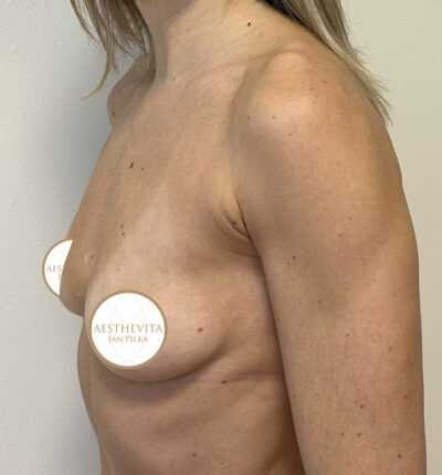 mia-femtech-021-pred