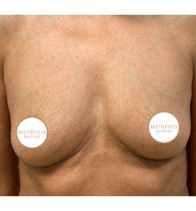 mia-femtech-009-pred