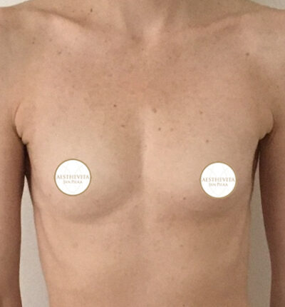 mia-femtech-011-pred