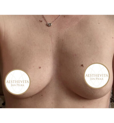 mia-femtech-023-pred-1