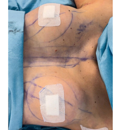 mia-femtech-028-po-1