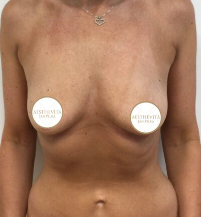 mia-femtech-032-pred