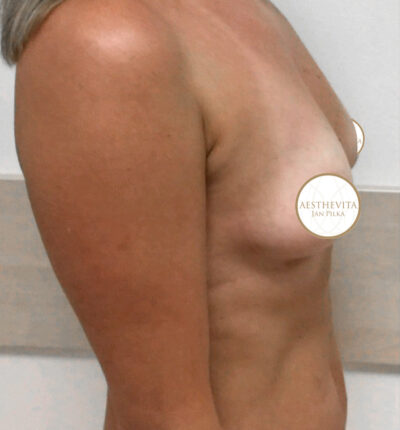 mia-femtech-041-pred