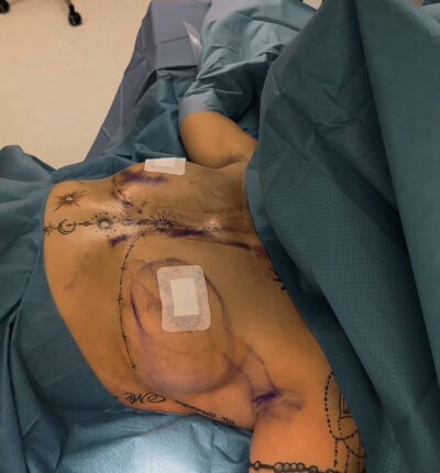 mia-femtech-045-pred