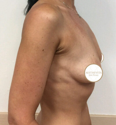 mia-femtech-050-pred