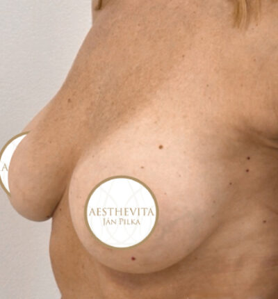 mia-femtech-052-po-1