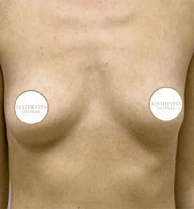 mia-femtech-058-pred